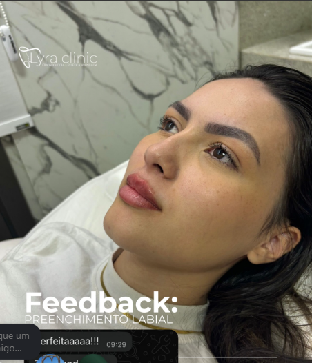 Feedback de preenchimento labial
